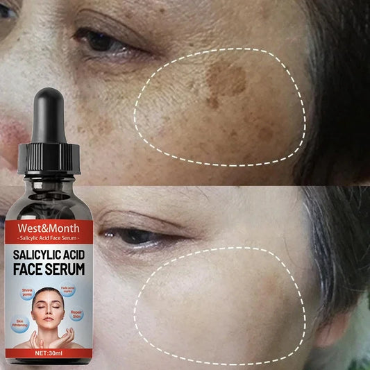 Powerful Spot-removing Whiten Facial Serum Niacinamide Salicylic Acid Moisturizing  Skin Care Products 2025